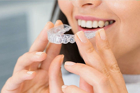 Patient holding a clear orthodontic aligner